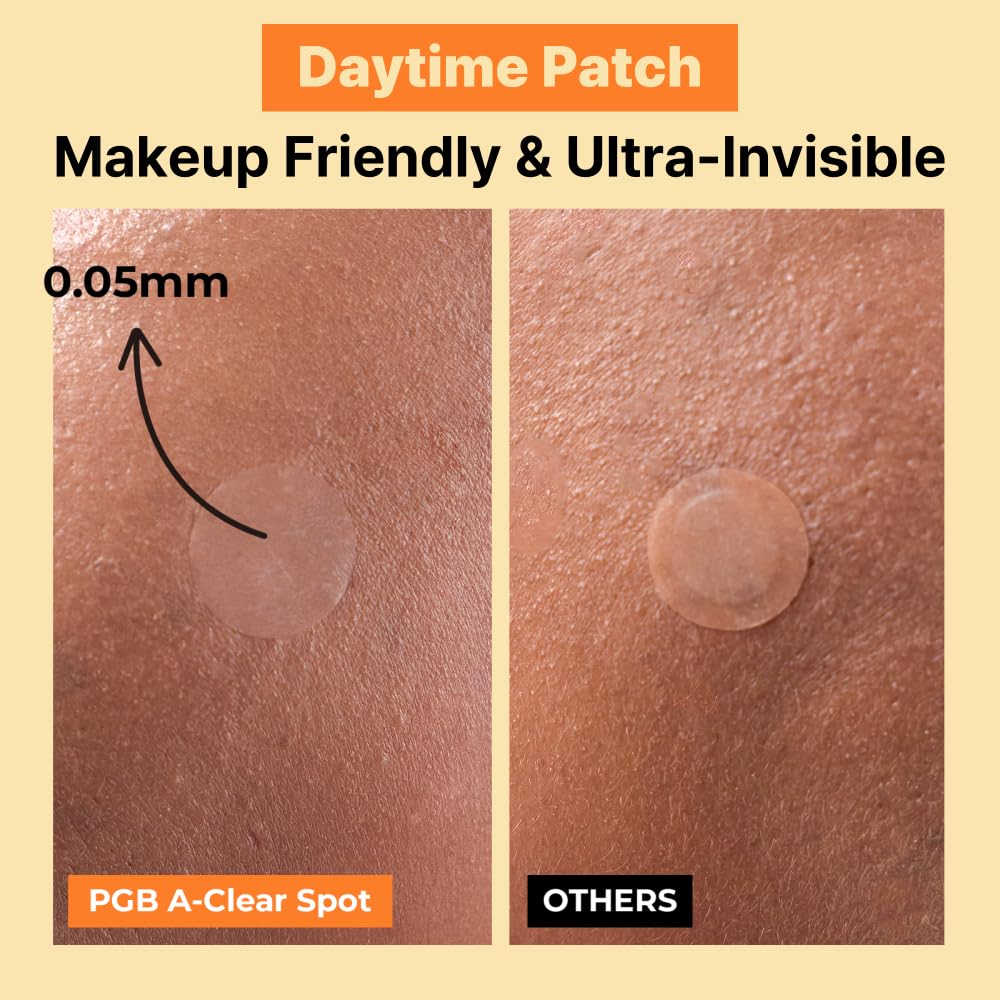 Pimple Patches, 3 Sizes – Day & Night Hydrocolloid Acne Patches – Invisible, Absorbs Zits & Blemishes, Korean Skin Care (174 Count)