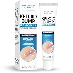 Keloid Bump Removal, Scar Removal Cream, Keloid Bump Removal, Scar Removal Cream,