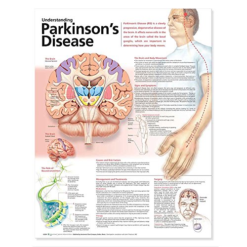 Understanding Parkinson's Disease Anatomical Chart
