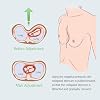 Pectus Excavatum Vacuum Bell, Pectus Excavatum Orthosis Brace with Pressure Gauge, Easy to Clean and Maintain, for Adults and Child,Physical Correction of Pectus Excavatum,Vacuum bell therapy