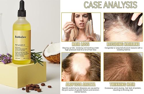 Miniatura 2 de Veganic Aceite Natural para el Crecimiento del Cabello,Aceite Vegánico para el Crecimiento del Cabello,Aceite de Romero para el Crecimiento del