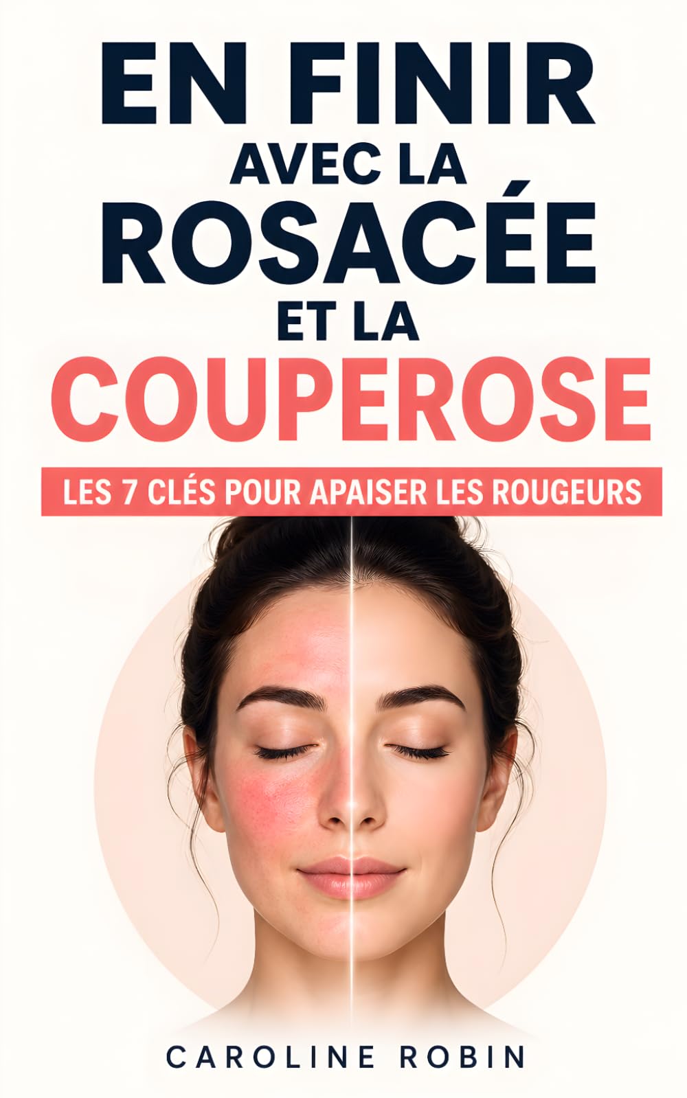 En Finir avec la Rosacée et la Couperose: Les 7 Clés pour Apaiser les Rougeurs, Protéger sa Peau et se Sentir Mieux au Quotidien | Livre Rosacée et ... Rosacée et Anti Rougeur | Soin de la Peau
