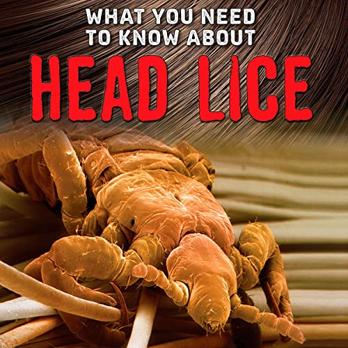 What You Need to Know About Head Lice by Nancy Dickmann episode artwork