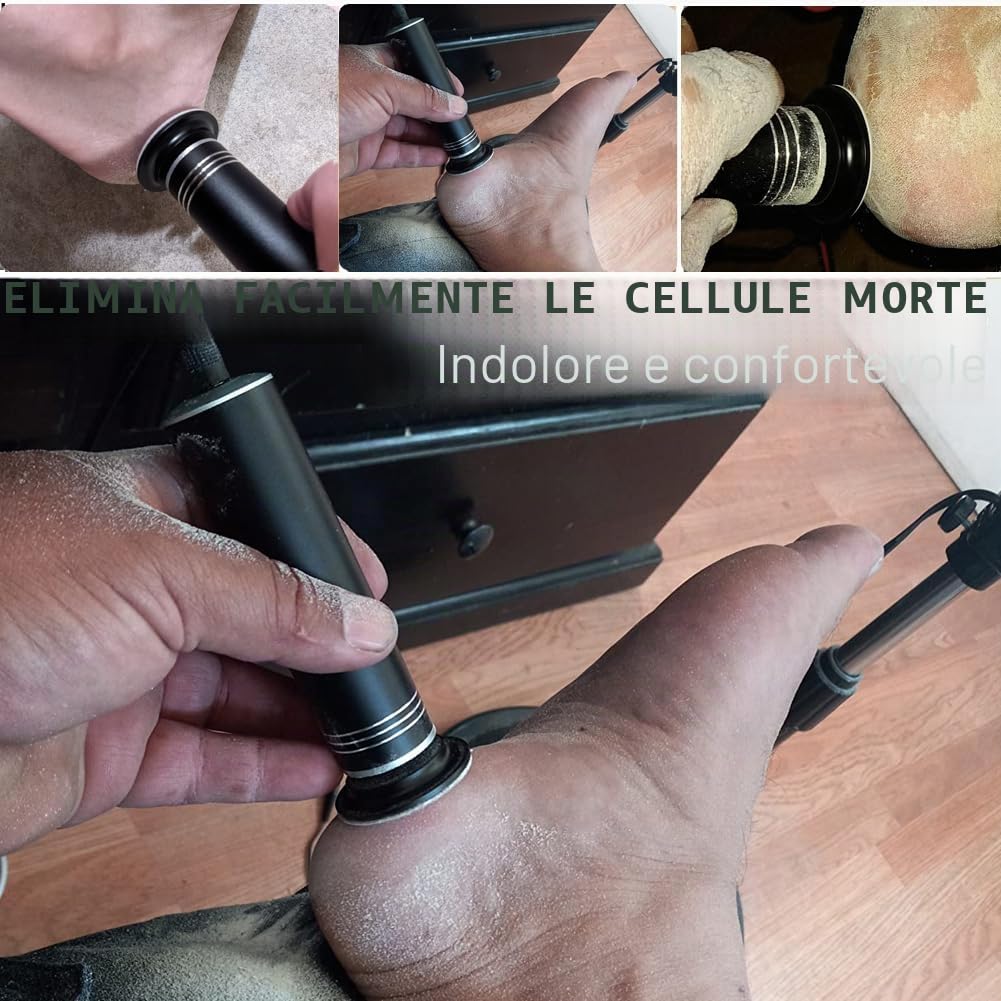 Grattugia Elettrico Piede Professionale Anticalli Levigatrice Elettrica Per Piedi Più Velocità Regolabili (02Nero)