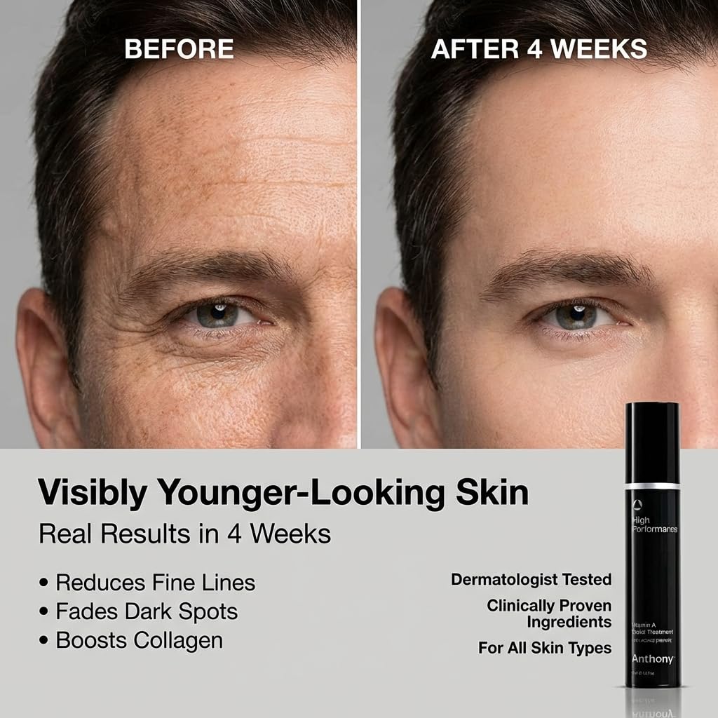 Anthony High Performance Vitamin A Treatment, Advanced Anti-Aging Face Cream with Shea Butter & Squalane, Anti-Wrinkle Moisturizer for Youthful Skin, Safe for Sensitive Skin, 1.6 Fl Oz