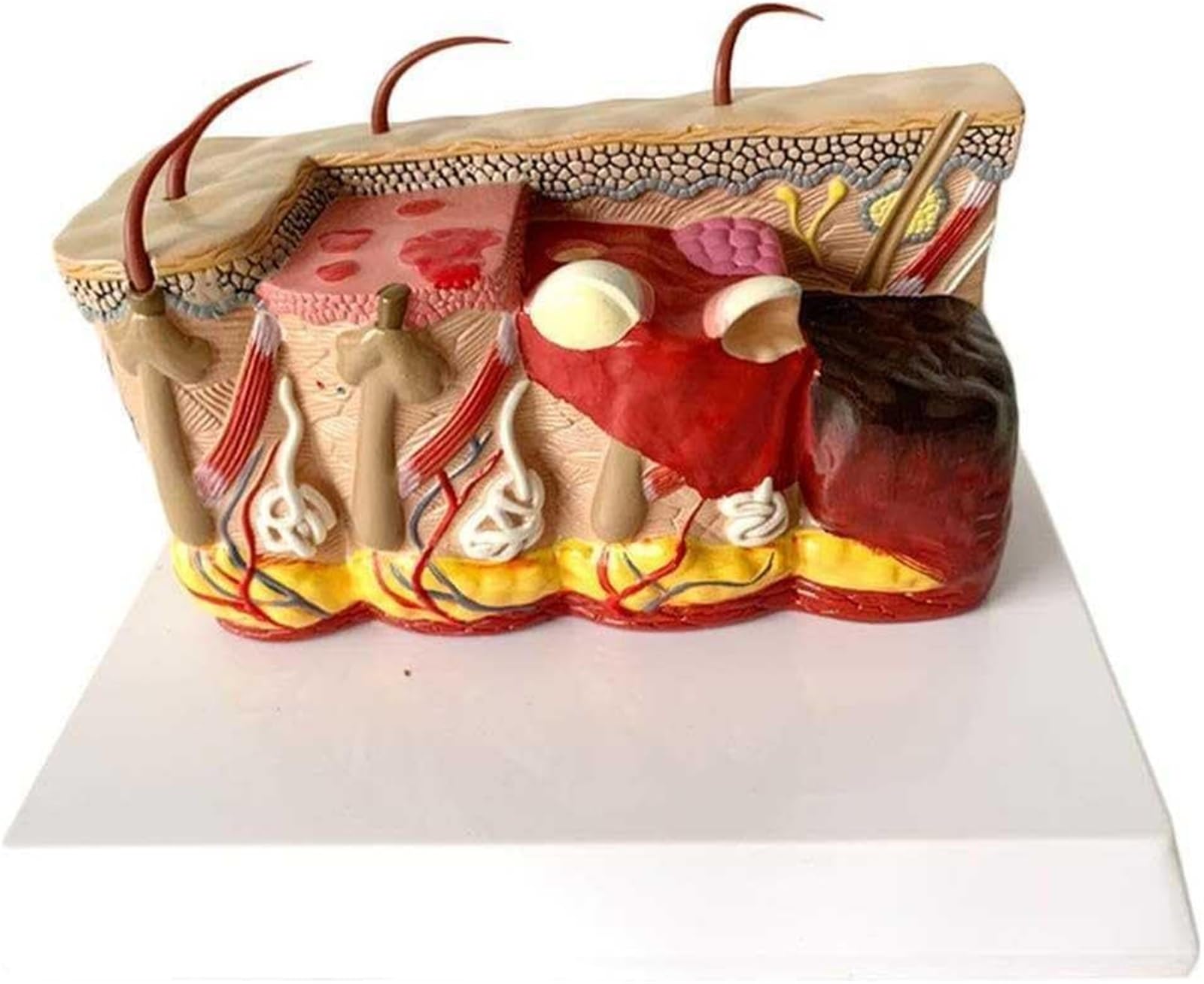 KJMWXOP Skin Anatomical Model, Skin Burn Anatomical Model, Human Burn Skin Model Medical Anatomical Model, Organ Anatomy Model