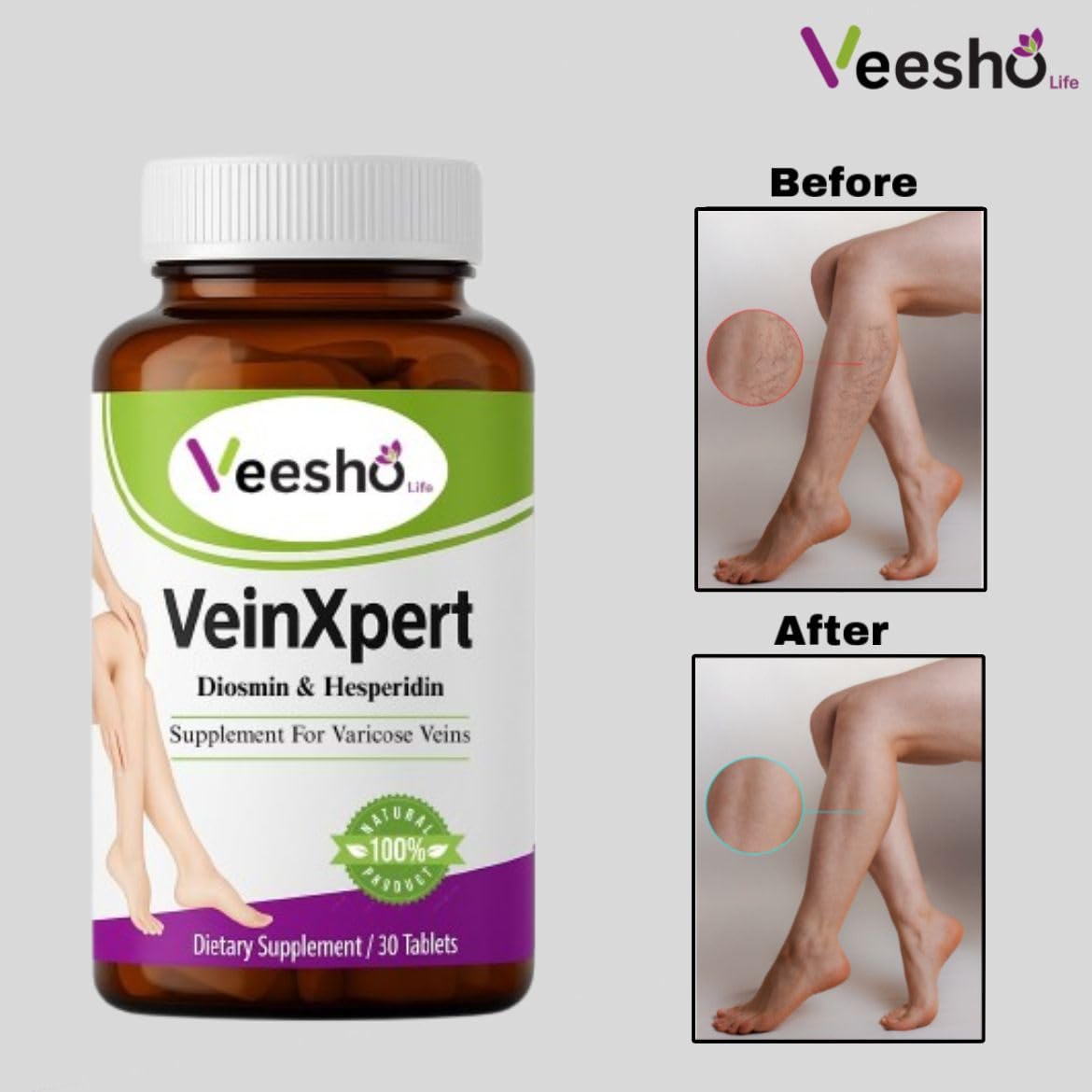 VeinXpert Varicose Vein Support | Ayurvedic Supplement for Leg Swelling, Heaviness & Pain Relief | Natural Circulation & Vein Health Formula| 60 Tab 2