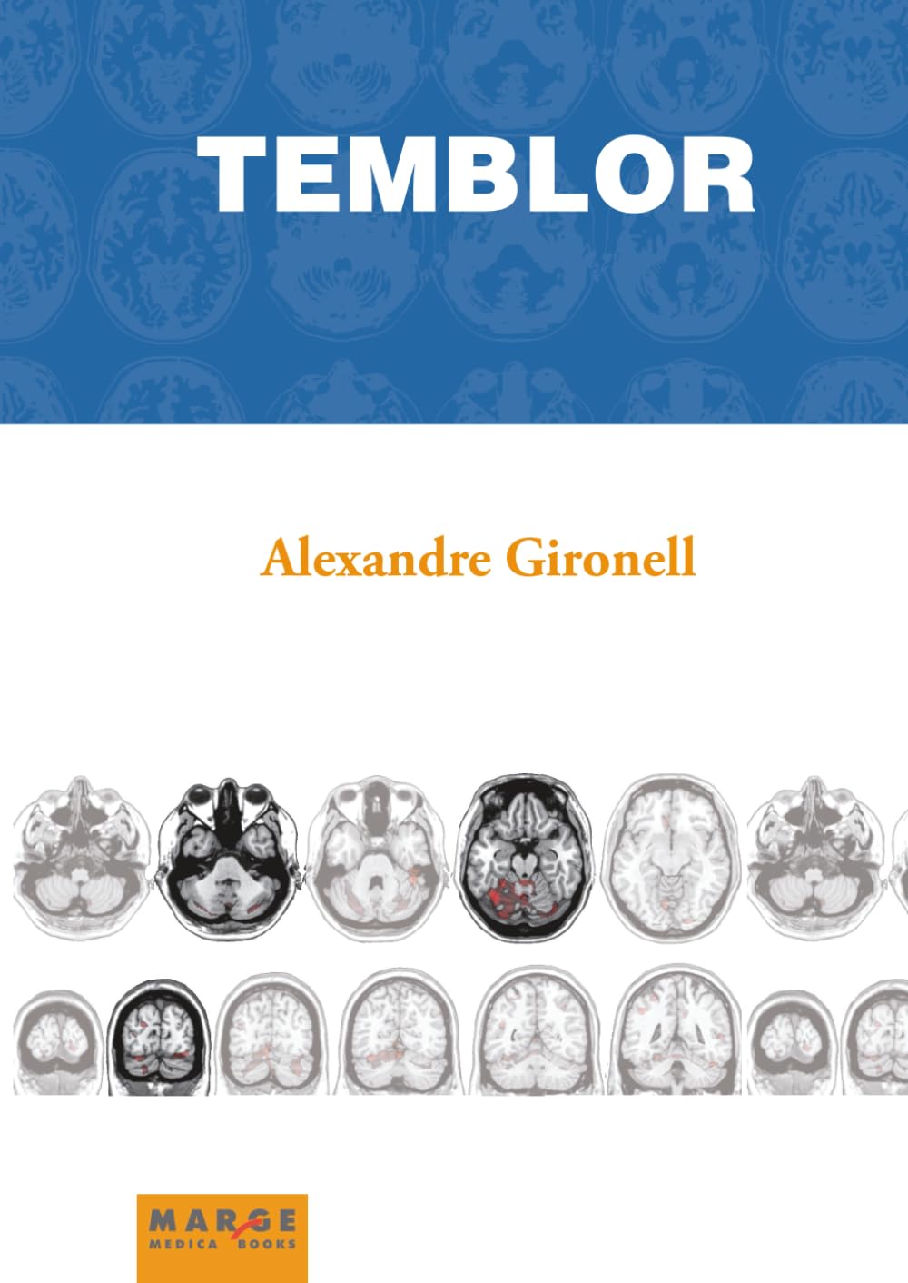 Temblor (Medicina y Ciencias de la Salud)