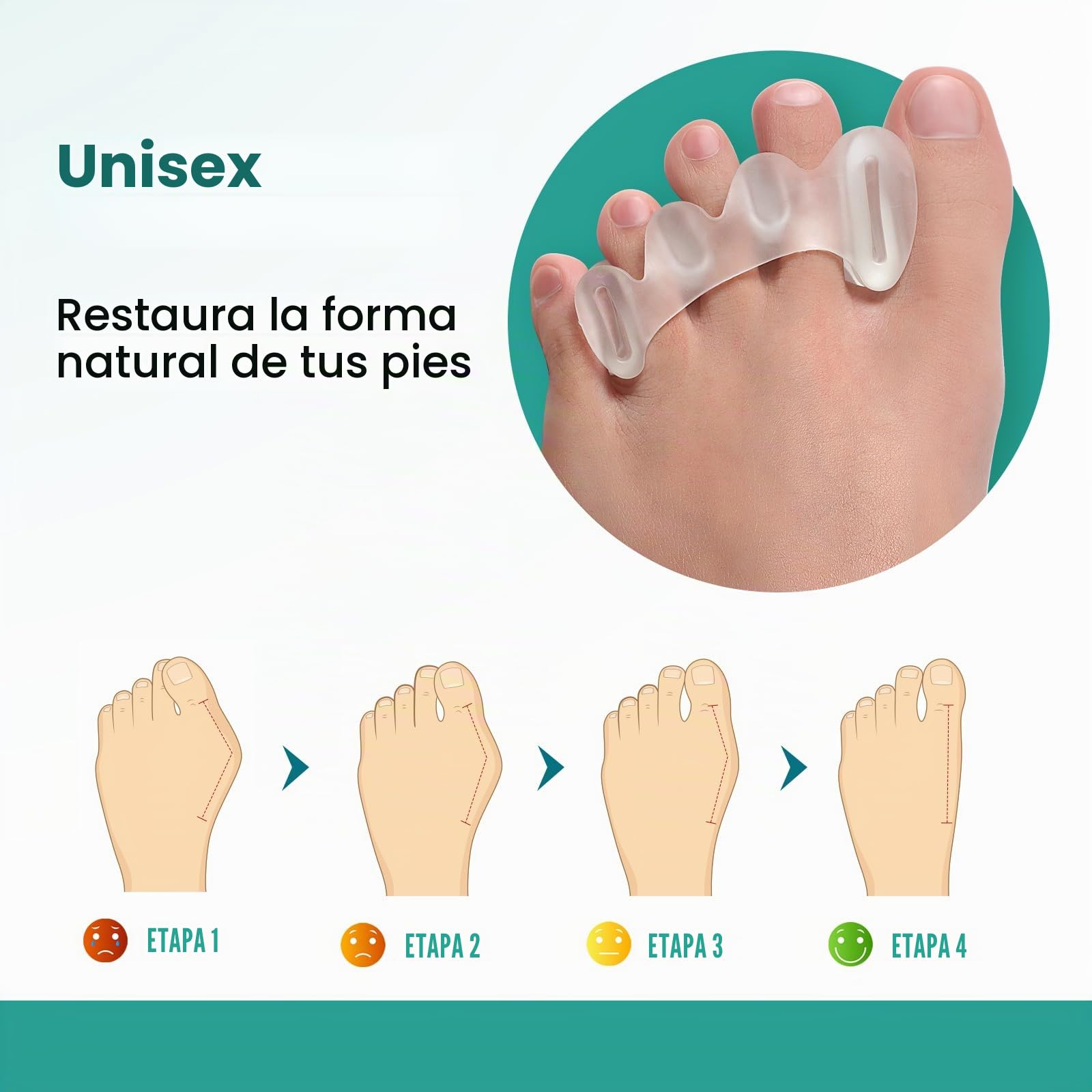Welnove Separadores de Dedos para Corregir Juanetes - Separadores de Dedos para Mujeres y Hombres, Alivio del Dolor, Alineación de Pies, Enderezadores Ajustables (2 Pares con Caja de Regalo)