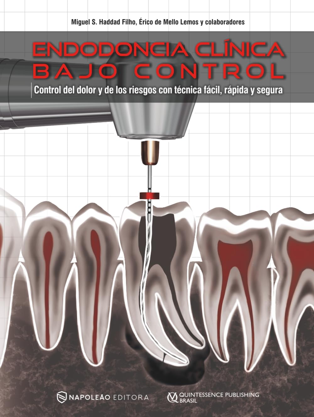 Endodoncia Clínica Bajo Control: Control del dolor y los riesgos con técnica fácil, rápida y segura