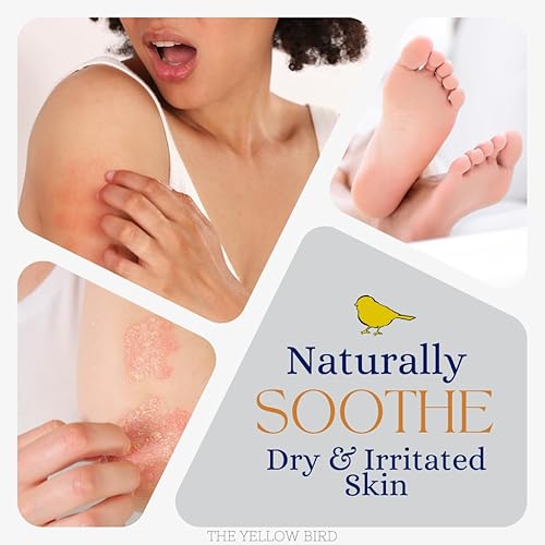 Miniatura 4 de Yellow Bird - Bálsamo natural calmante para pies y cuerpo, hidratante para todo tipo de piel, crema orgánica para aliviar la picazón, bálsamo para