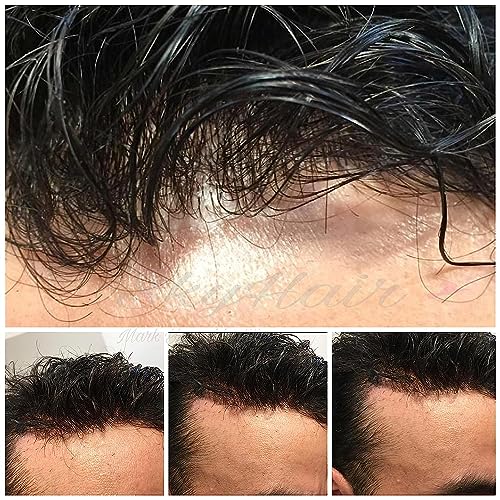 Image of SkyHair 100% Remy Hair Australian Mirage Hair Patch Transparent Poly PU Front and Border, Natural Front Hairline Skin Base for Real Looking Scalp Undetectable Toupee PREMIUM System (Black, 9x6)