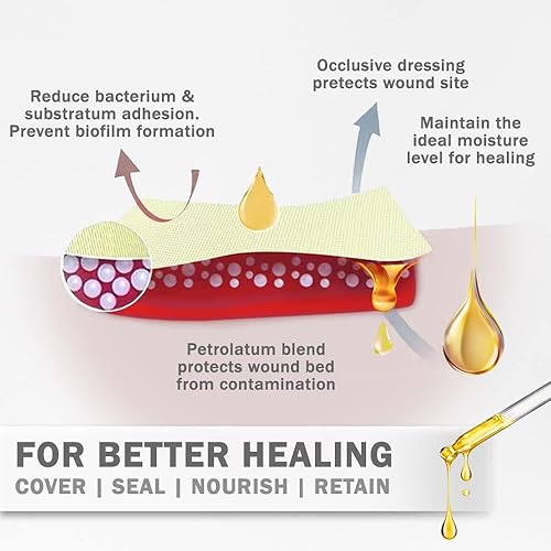 Miniatura 5 de EVERLIT Xeroform Apósito de Petrolato  Almohadilla de Gasa de Malla Fina Oclusiva Estéril y No Adherente  Parche No Tóxico y Suave para Quemaduras,
