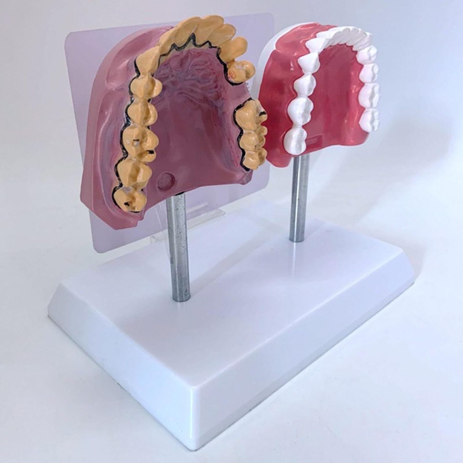 Modello Anatomico dei Denti del Orale Umano, Struttura Anatomica Accurata E Patologica, per Studenti di Odontoiatria