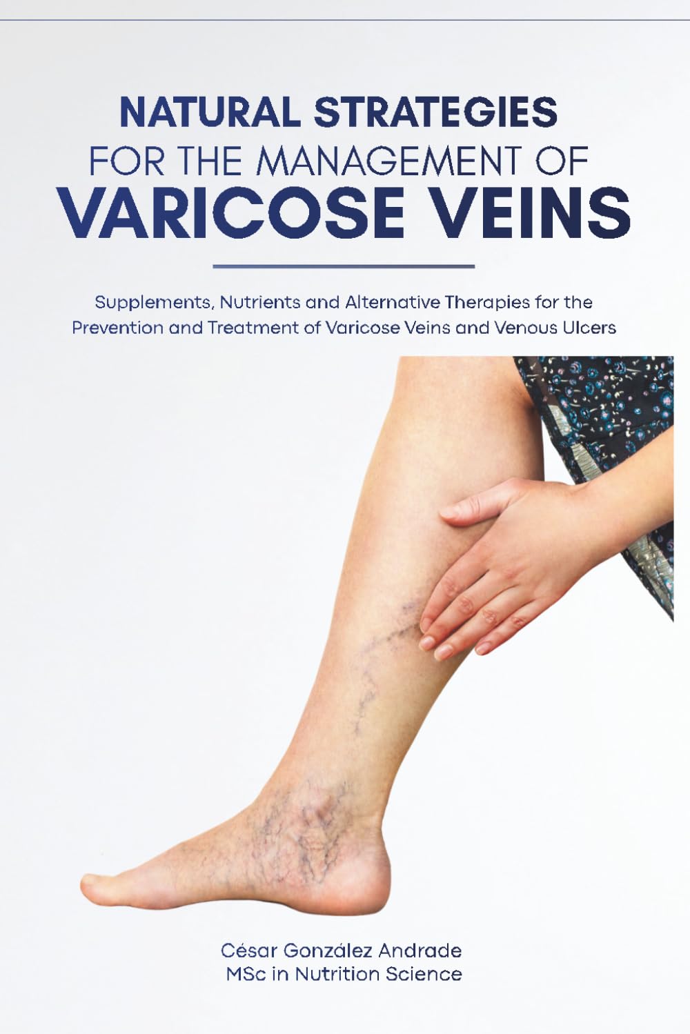 Natural Strategies for the Management of Varicose Veins: Supplements, Nutrients and Alternative Therapies for the Prevention and Treatment of Varicose ... Ulcers (Evidence-Based Nutrition and Health)
