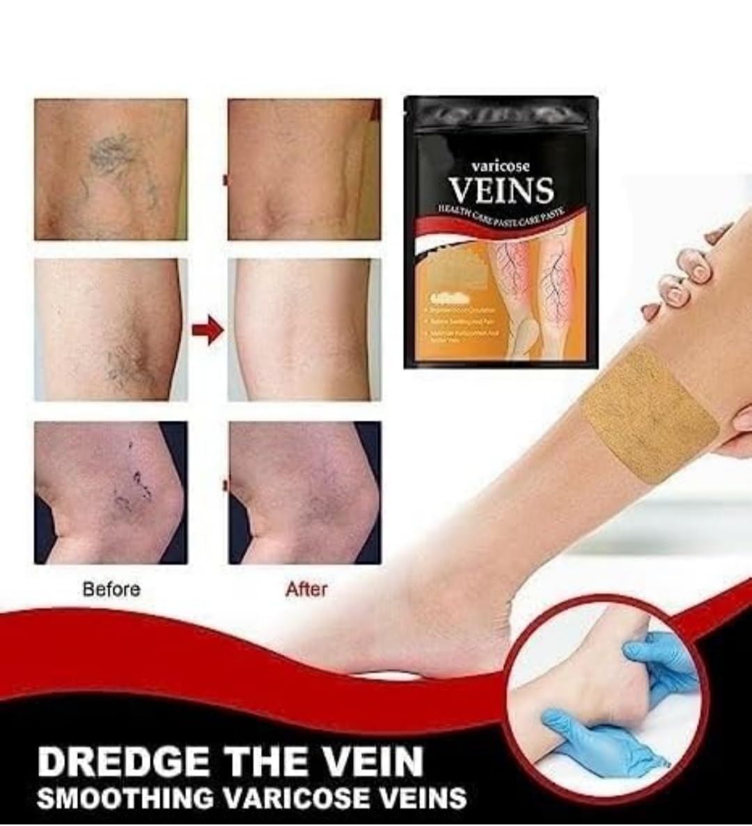 SEINON'S Varicose Veins Patches Dredge Vein Smoothing Varicose Veins Reduce Swelling Relieve Pain Instant Relief From Muscular Pain Improve Blood Circulation Skin Friendly 3