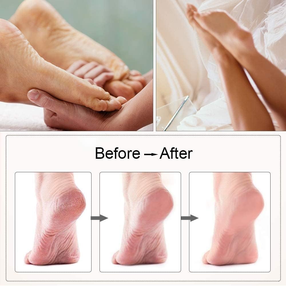 Electric Rechargeable Foot Grinder Heel File Grinding Exfoliator Pedicure Machine Care Tool Dead Skin