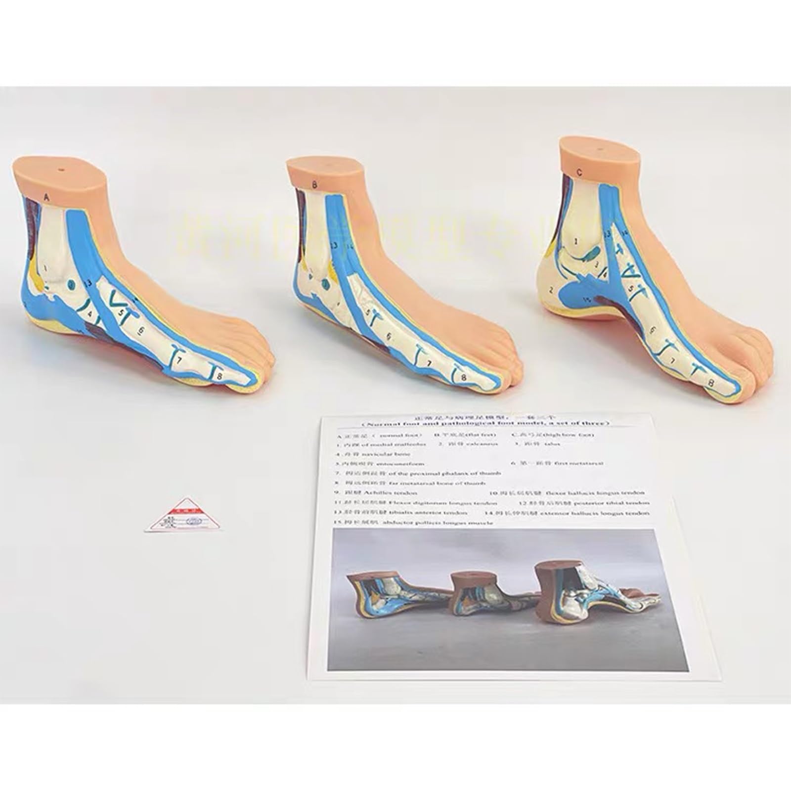 3-częściowy model stóp, modele anatomiczne patologii stóp człowieka, w tym stopy płaskostopie, stopy z wysokim podbiciem i stopy normalne, materiał PVC do szkoły i edukacji