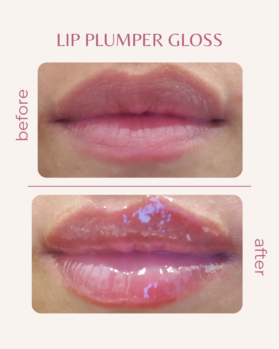 JLipShine Rose Lip Plumper Gloss – Hydrating Lip Plumping Oil with Hyaluronic Acid, Peptides & Vitamin E – Moisturizing High Shine Lip Gloss Treatment – Vegan Nourishing Lip Enhancer (Mild)