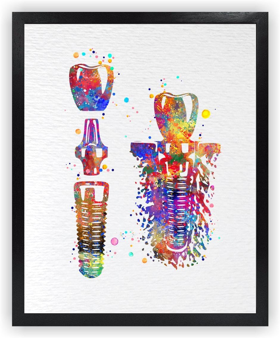 Dignovel Studios 11X14 Unframed Dental Implant Watercolor Art Print Poster Tooth Anatomical Dental Clinic Dentistry Educational Wall Hanging Decor DN915