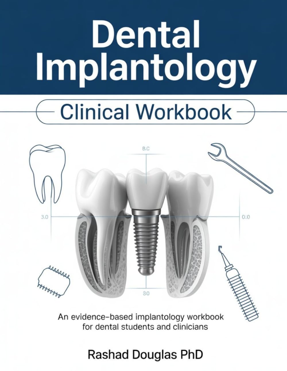 DENTAL IMPLANTOLOGY CLINICAL WORKBOOK: An Evidence-Based Implantology Workbook for Dental Students and Clinicians