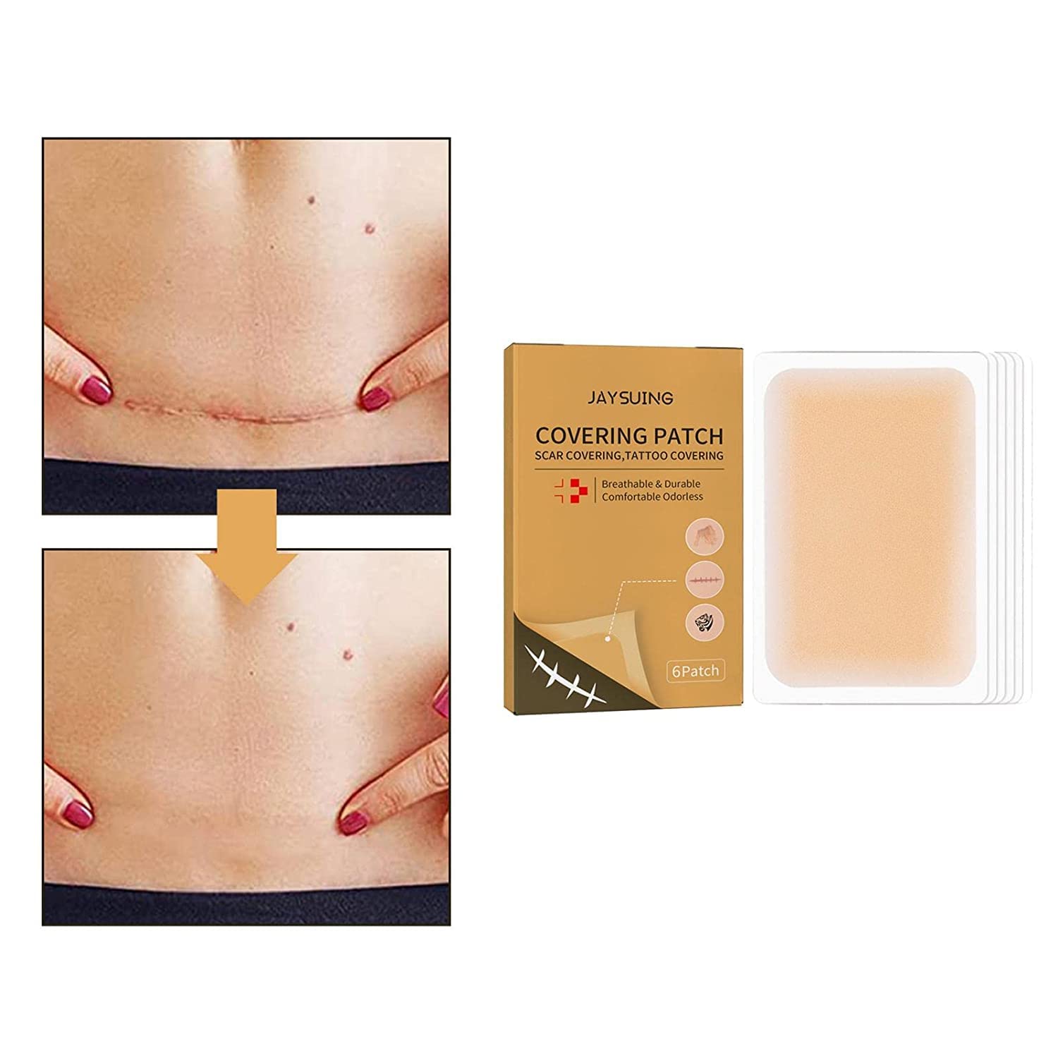 RADIONICS 6X Tattoo Cover Up Sticker | Breathable & Waterproof Skin Concealing Tape for Tattoos, Scars & Stretch Marks | Invisible, Long-Lasting Coverage for Body & Face 4