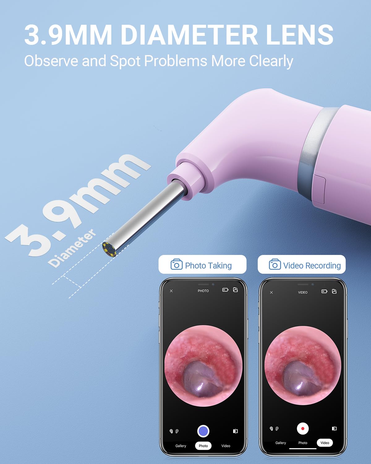ScopeAround Otoscopio con luz, cámara de oído con doble vista, alcance de oído WiFi de 720pHD con 6 luces LED, cámara otoscopio de lente de 3.9 mm para niños y adultos, compatible con iPhone y Android