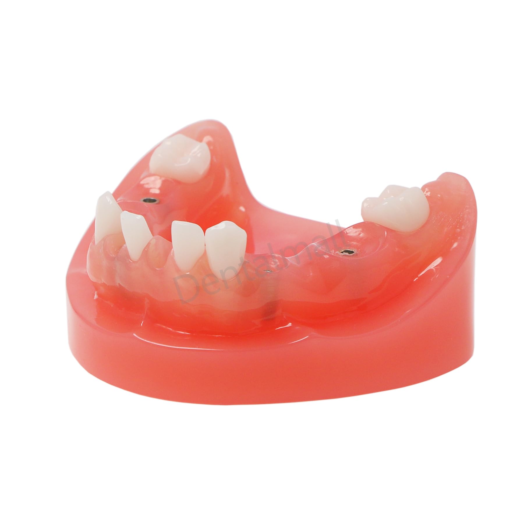 Dental Implant Typodont Restoration Teeth Model Lower Jaw M6019