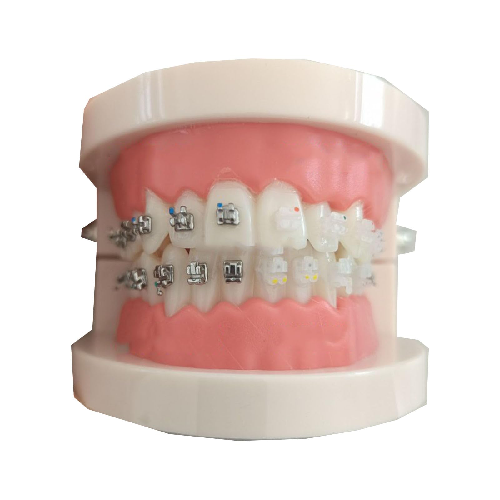 LKYLVEE Dental Orthodontic Demonstration Model - Standard Teeth Model - Treatment Model with Metal Bracket,Arch Wire Explaining Model with Braces,J,8cm