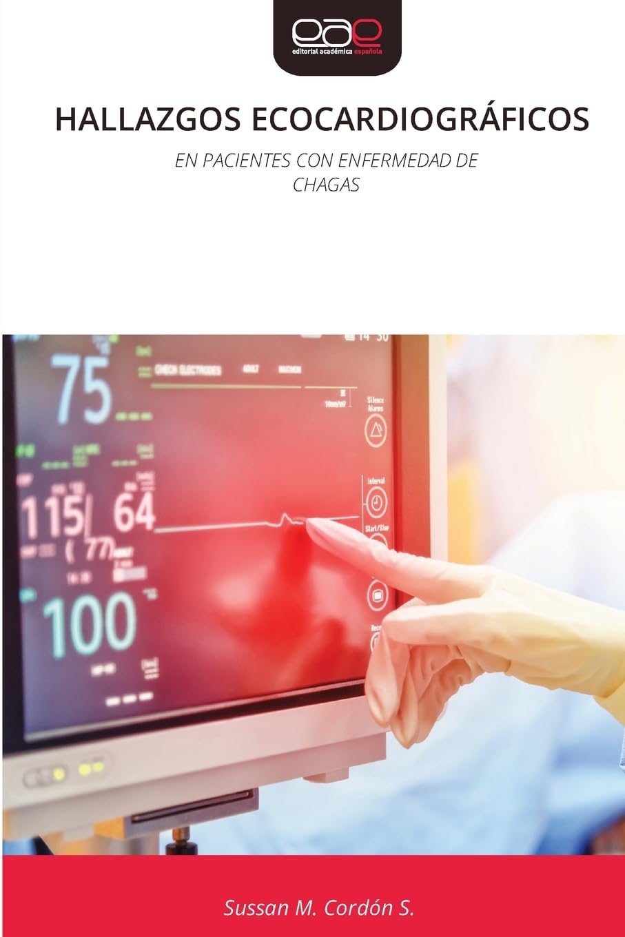 HALLAZGOS ECOCARDIOGRÁFICOS: EN PACIENTES CON ENFERMEDAD DECHAGAS