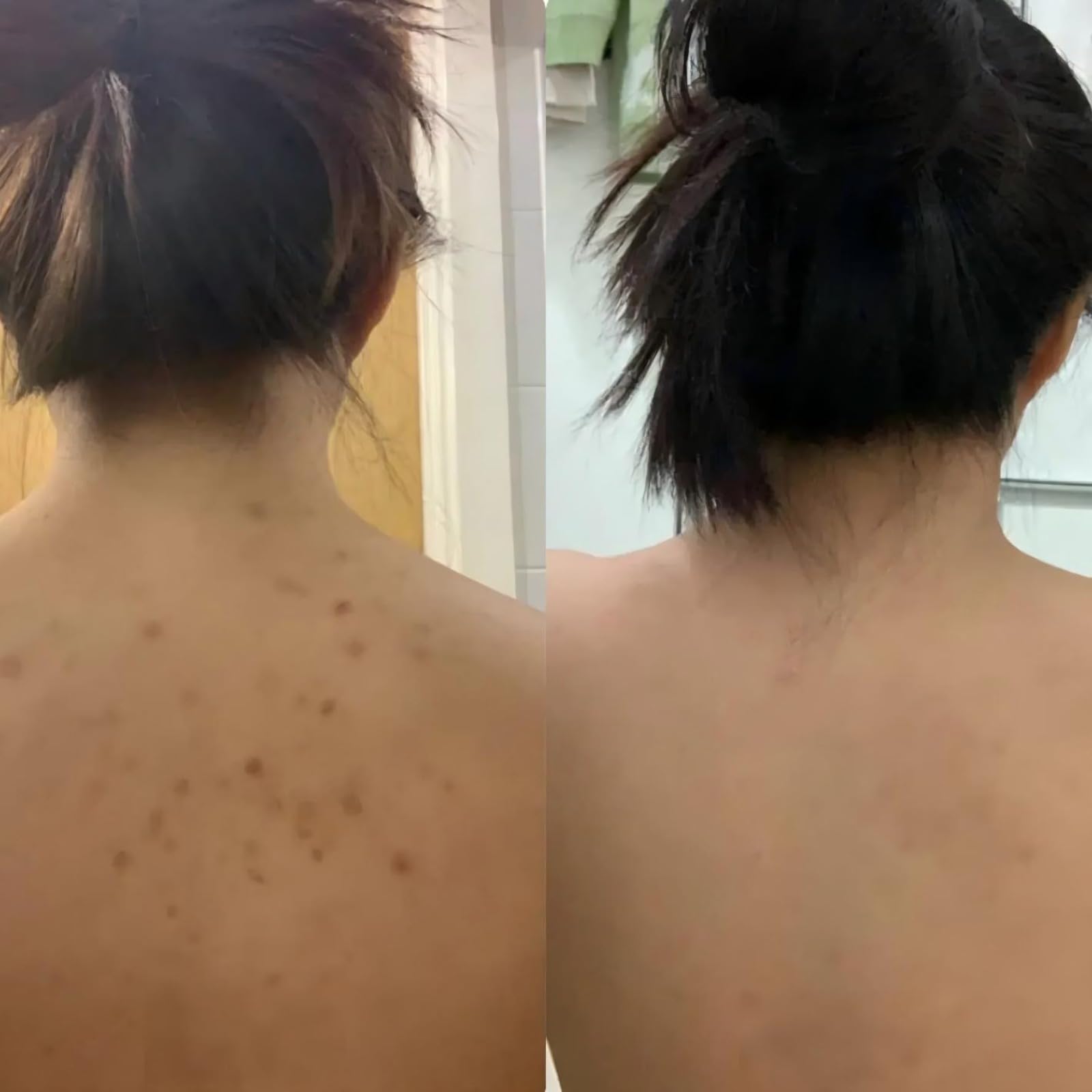 Duschtuch Peeling - Hammam Peeling-Duschtuch, Rücken Körper Peeling Duschtuch für Männer Frauen, Echte Tiefenreinigung in 3 Minuten (1 Pcs Schwarz)
