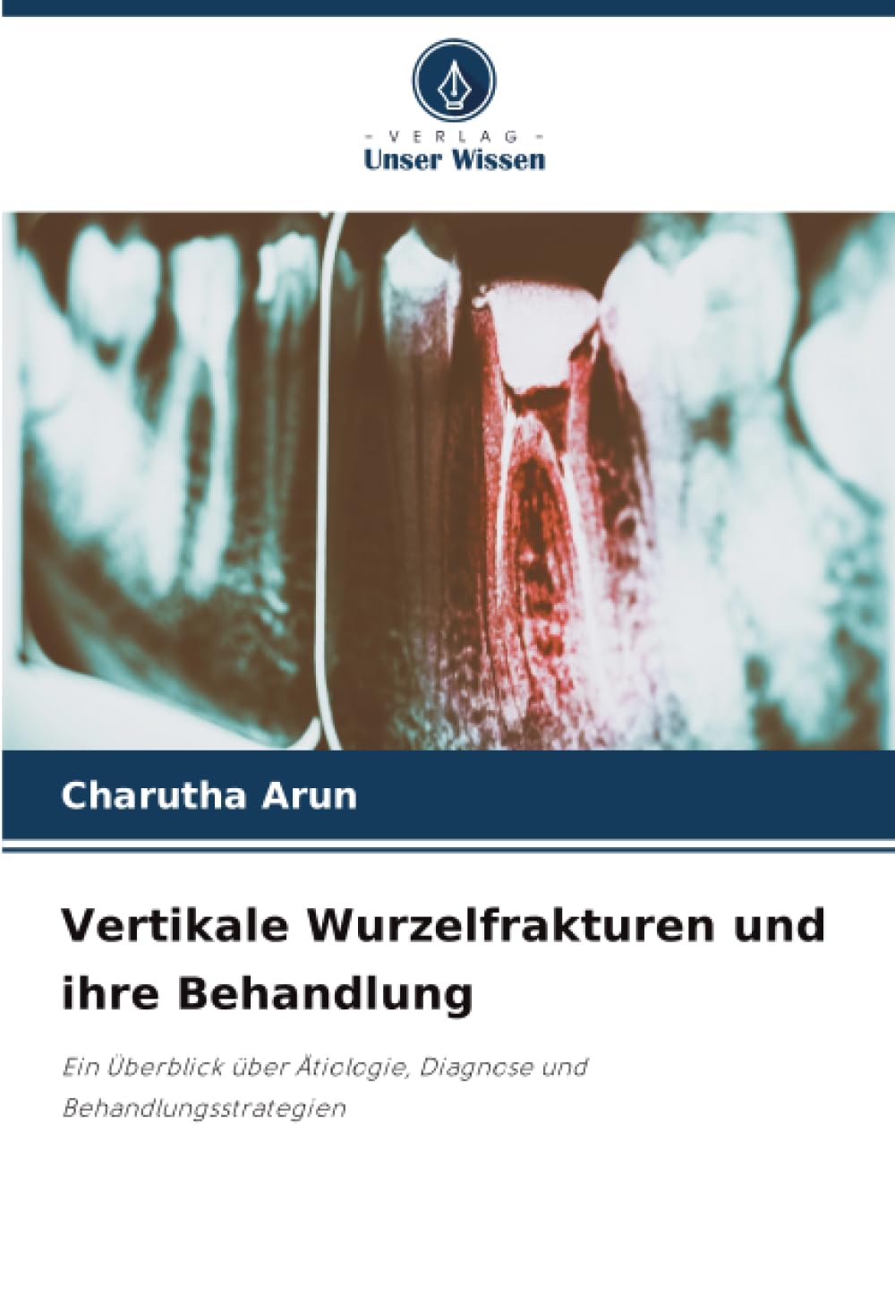 Vertikale Wurzelfrakturen und ihre Behandlung: Ein Überblick über Ätiologie, Diagnose und Behandlungsstrategien