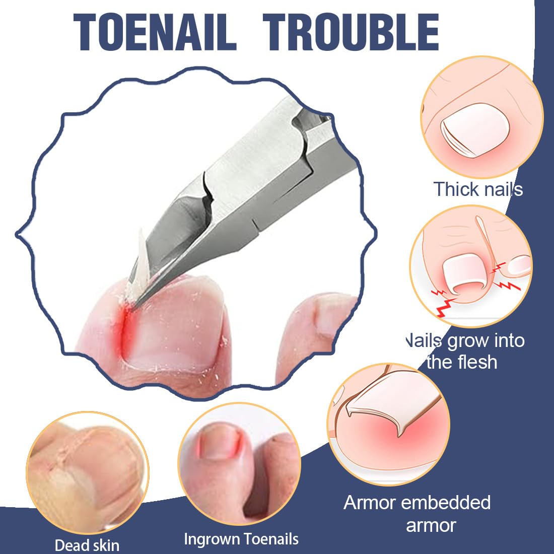 Taglia Cuticole Professionale, Tronchese Per Unghie Spesse Incarnite con Spingi Cuticole,Tronchese Unghie, Tronchesino Tagliaunghie Professinale, per Unghie Spesse e Dure Pedicure e Manicure Strumenti