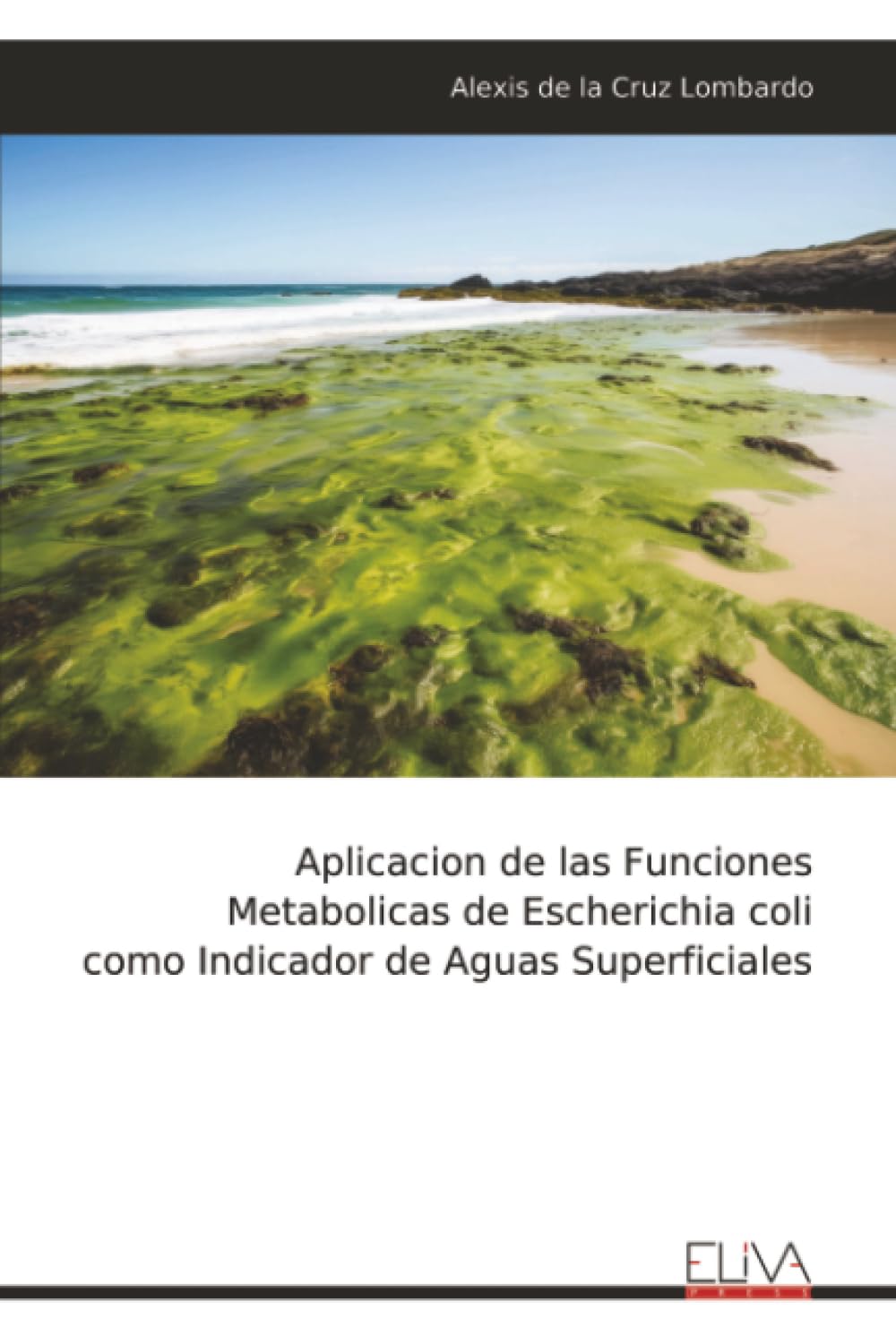 Aplicacion de las Funciones Metabolicas de Escherichia coli como Indicador de Aguas Superficiales