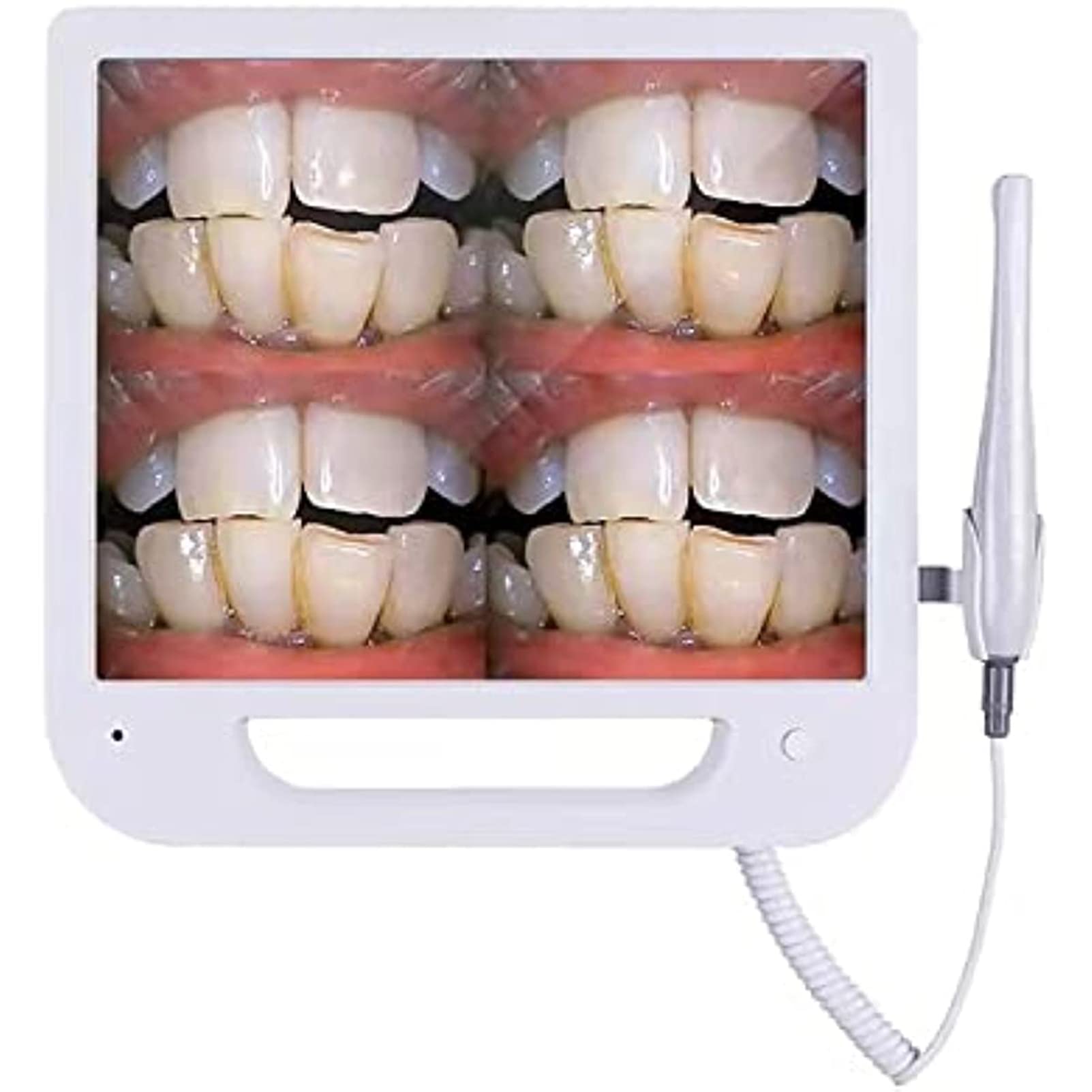 Cámara Intraoral Dental, Endoscopio Médico VGA con Monitor De Pantalla De 17 Pulgadas/escáner Intraoral Digital, Sistema De Imágenes De Video Digital para Fotografía Dental Intraoral