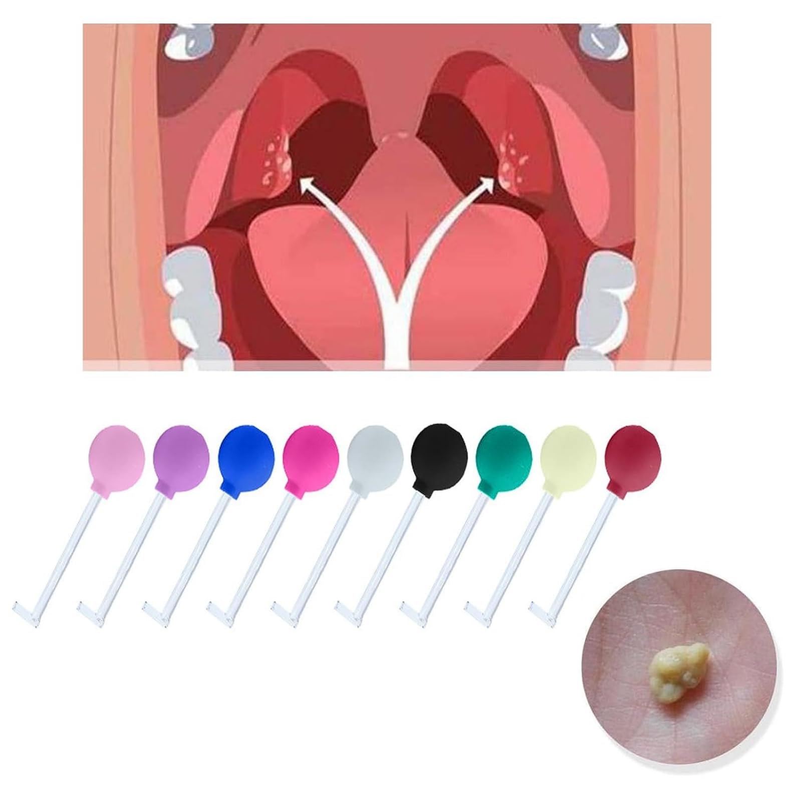 Tonsil Stone Removal Kit Manual Style Cleaner Removal Cleaning Mouth Cleaning Oral Care Mouth Removal Suction Dental Cupping Tools (Random 1pcs)
