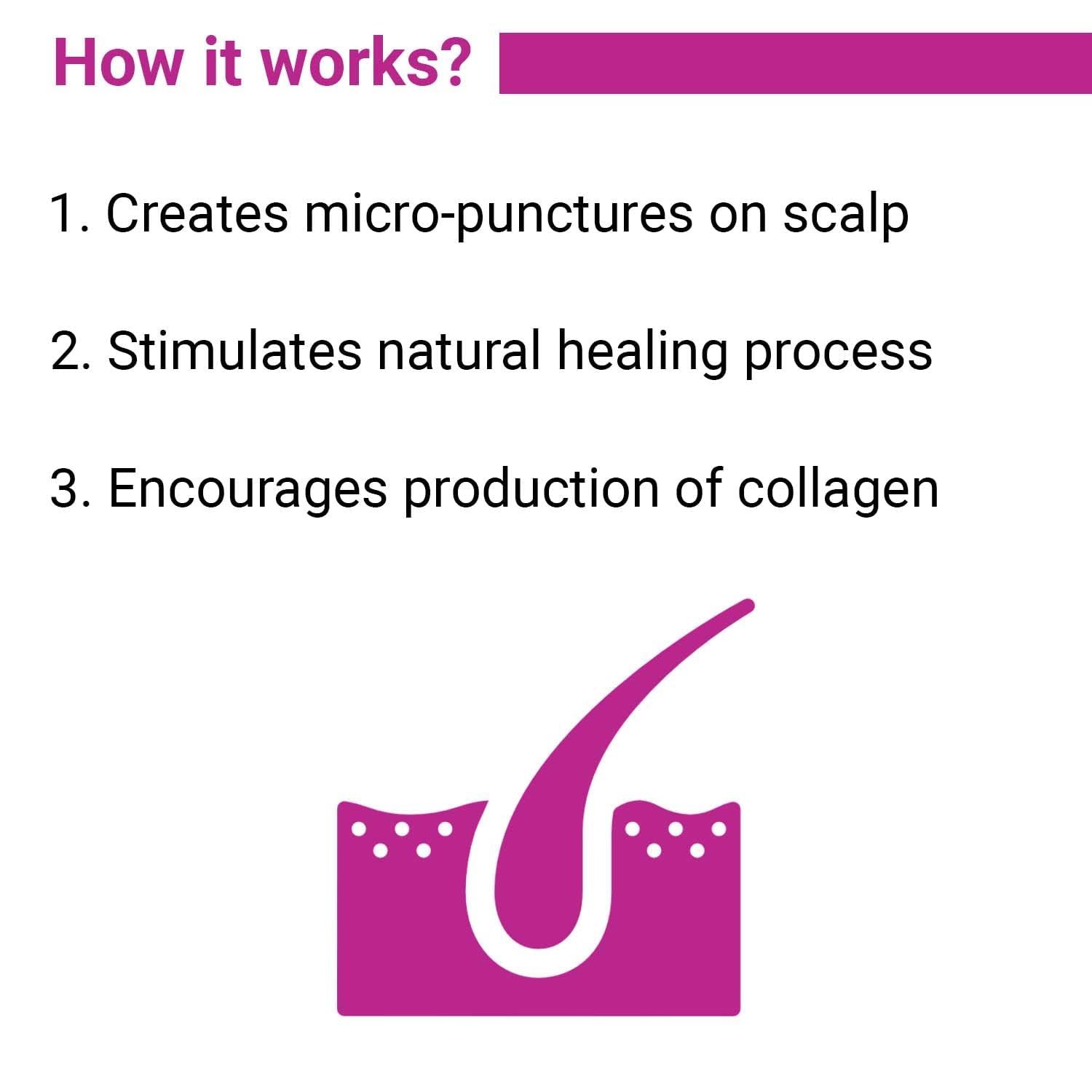 Sotrue Derma Roller do wzrostu włosów 0,5 mm z igłami tytanowymi 540 | Przedłużki do włosów damaged, aktywizujące włosy do włosów i grubych włosów, łatwe w użyciu