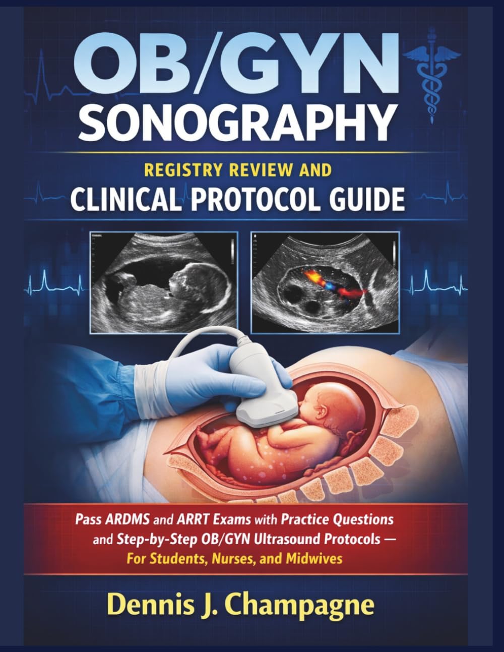 OB/GYN Sonography Registry Review and Clinical Protocol Guide: Pass ARDMS and ARRT Exams with Practice Questions and Step-by-Step OB/GYN Ultrasound ... Nurses, and Midwives (medical books)