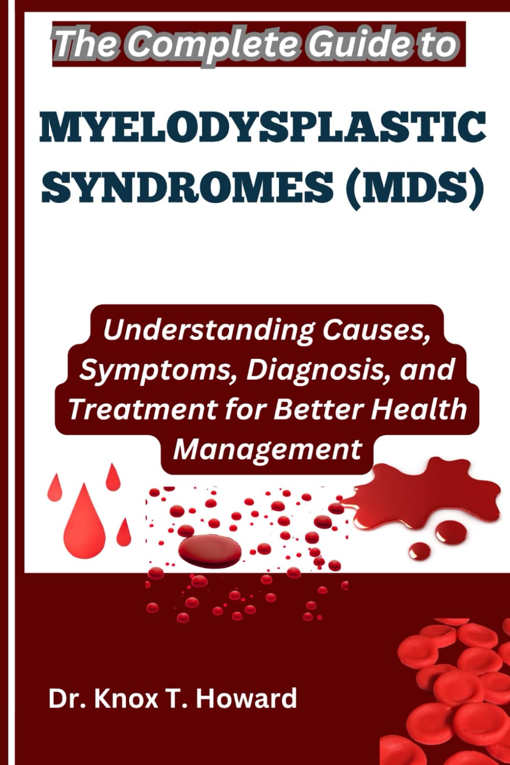 The Complete Guide to Myelodysplastic Syndromes (MDS): Understanding Causes, Symptoms, Diagnosis, and Treatment for Better Health Management