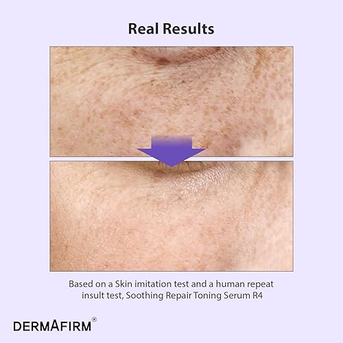 Miniatura 3 de DERMAFIRM Suero alternativo de retinol Bakuchiol coreano para arrugas con niacinamida y péptidos  Suero tonificante reparador calmante R4 para