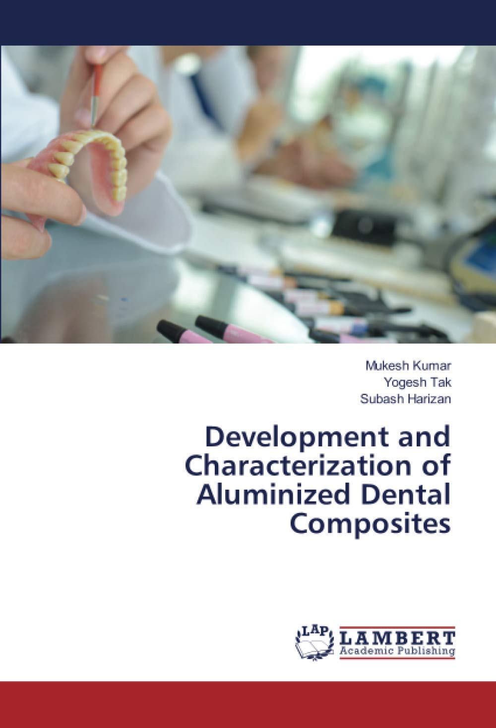 Development and Characterization of Aluminized Dental Composites