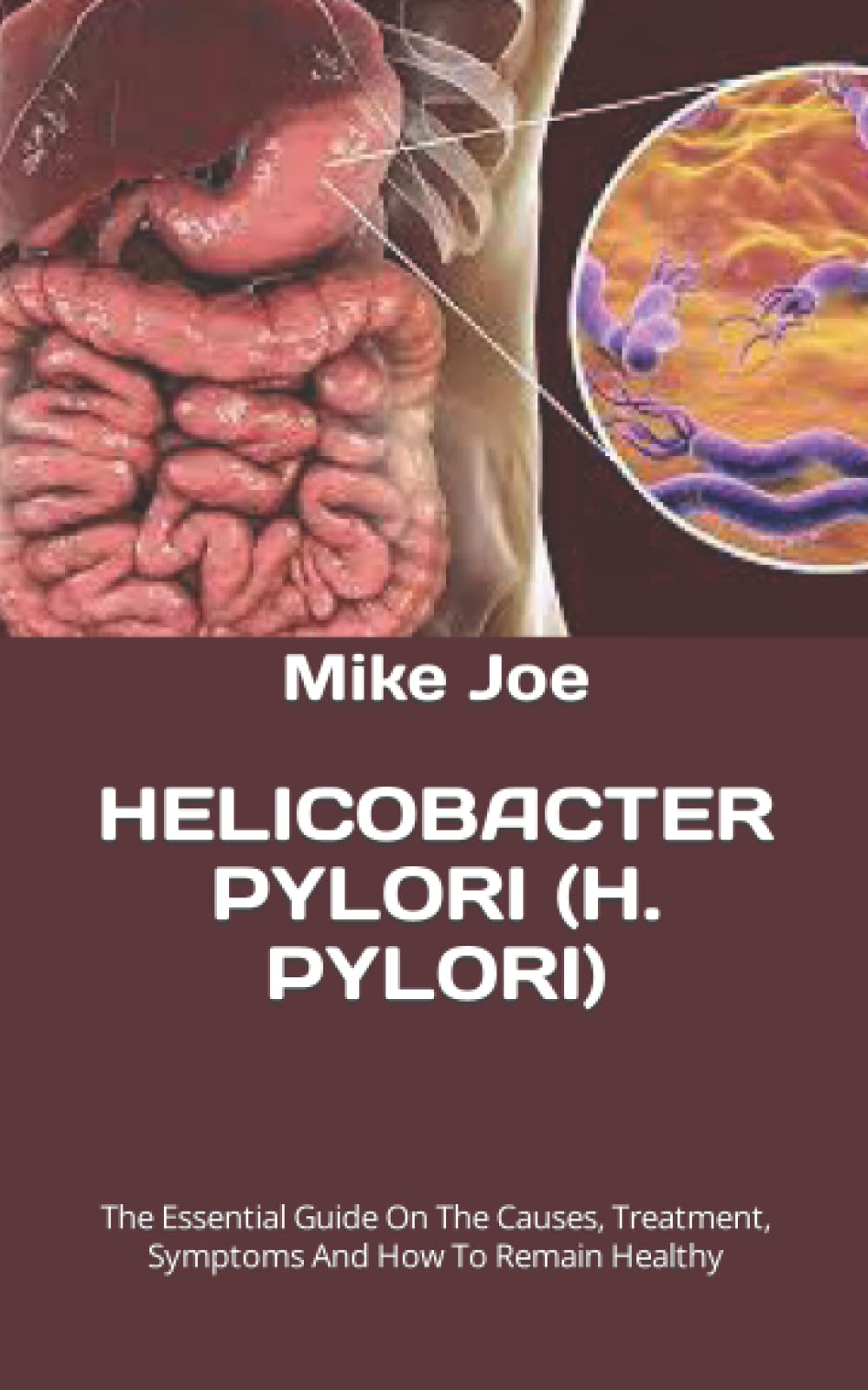 Buy HELICOBACTER PYLORI (H. PYLORI) The Essential Guide On The Causes