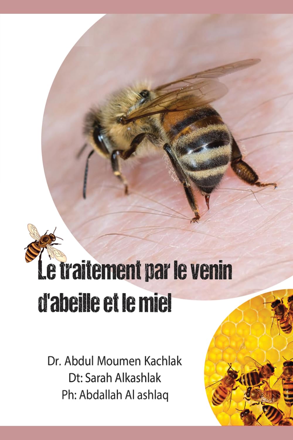 Le Traitement Par le venin d'abeille et le miel: l’apithérapie