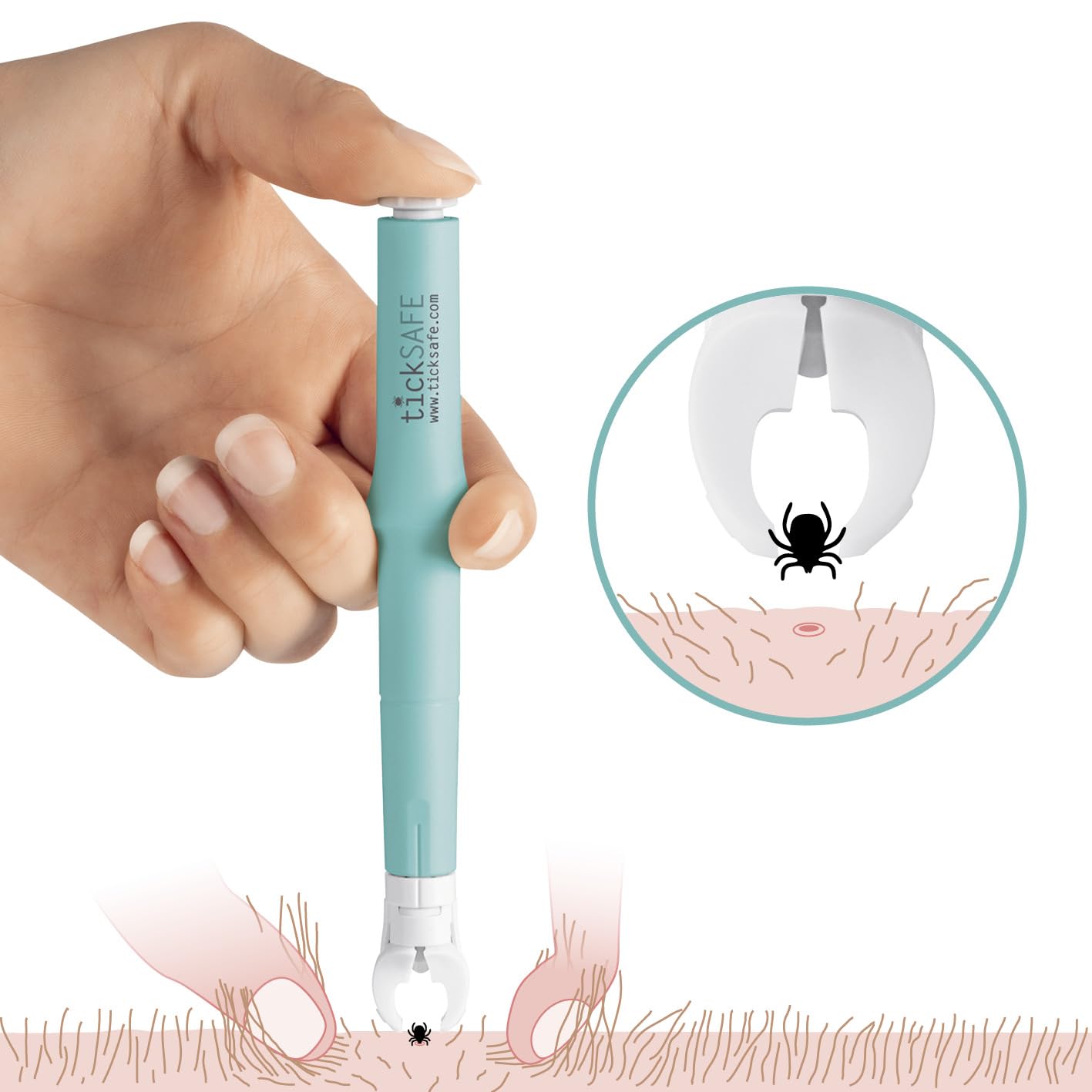 View 3