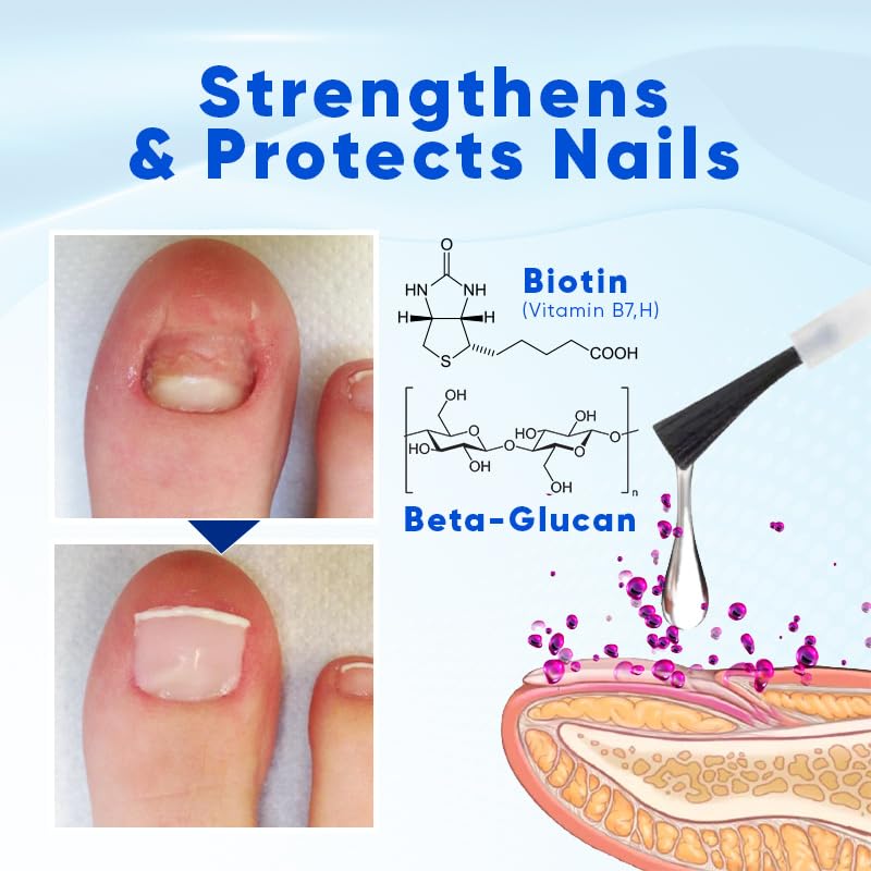 OnyxoGuard Nail Growth and Repair Serum, Advanced Nail Growth Serum, Nail Growth and Strengthener - Revitalize And Strengthen Your Nails 0.5 fl.oz (1 Bottle)