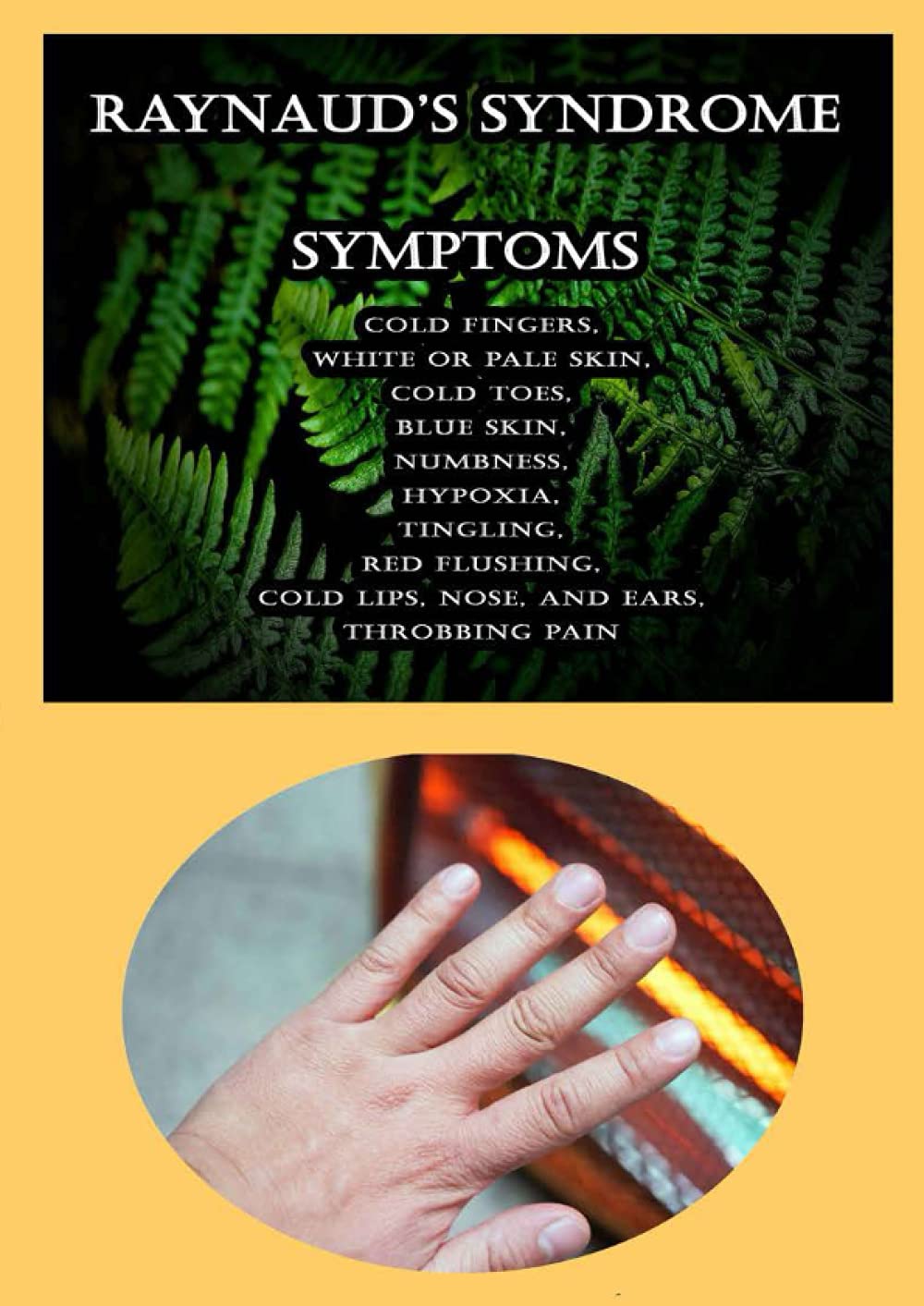 Buy Raynaud's Syndrome Symptoms Cold Fingers, White Or Pale Skin, Cold