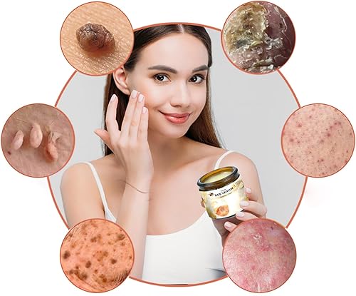Miniatura 6 de Bee Venom Crema de tratamiento de la piel, eliminación de la piel y cuidado de la piel para cara y cuerpo para todo tipo de piel, rápida y eficaz (1