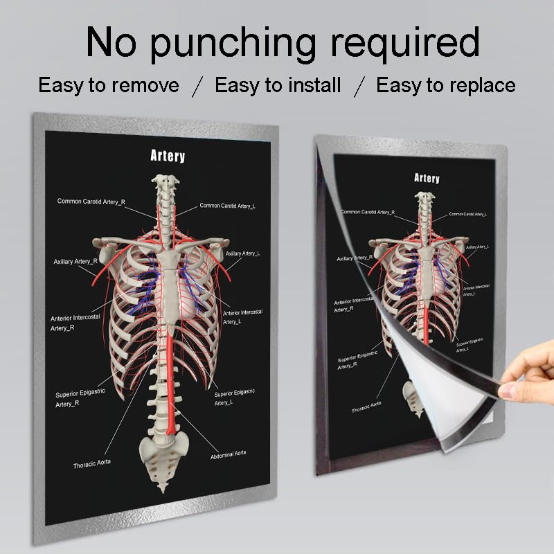 Image of Taanfu Body Educational Learning Anatomy Posters ，Arterial skeleton Art Arterial Villi Anatomy Art Poster Digestive System Organs Illustration Small Intestine Physiology Anatomy Wall Art Villi