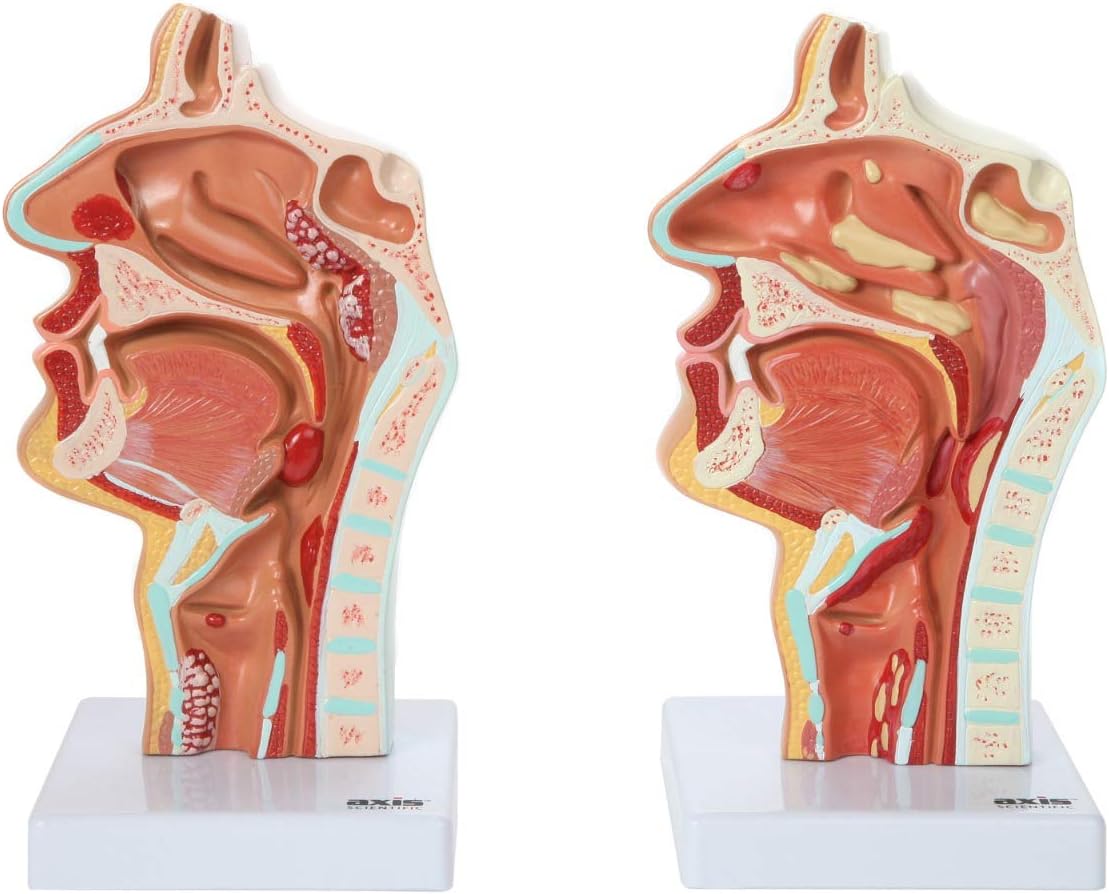 Axis Scientific Larynx and Pharynx Disorders Model