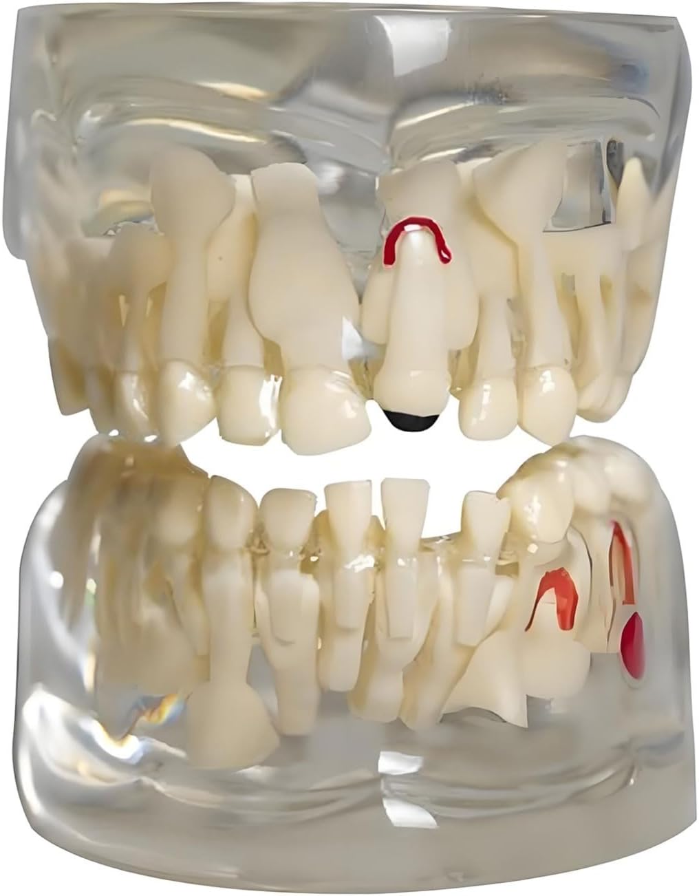 Transparent Children's Dental Model Deciduous Tooth Demonstration for Teaching Primary Teeth Anatomy
